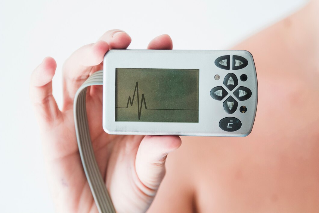 Edge-based ECG